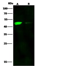 Invitrogen CCR1 Polyclonal Antibody 100 &mu;L; Unconjugated:Antibodies,