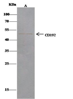 Invitrogen CCR2 Polyclonal Antibody 100 &mu;L; Unconjugated:Antibodies,