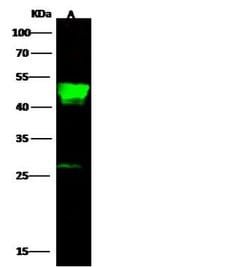 Invitrogen CCR2 Polyclonal Antibody 100 &mu;L; Unconjugated:Antibodies,