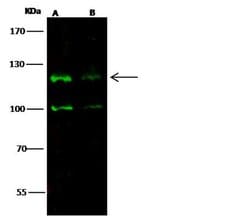 Invitrogen CD163 Polyclonal Antibody 100 &mu;L; Unconjugated:Antibodies,