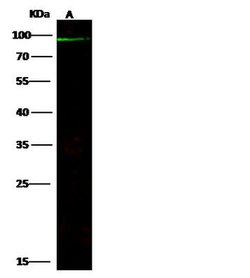 Invitrogen ABCB5 Polyclonal Antibody 100 &mu;L; Unconjugated:Antibodies,