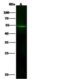 Invitrogen GLUT10 Polyclonal Antibody 100 μL; Unconjugated:Antibodies,