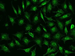 TIPIN Polyclonal Antibody:Antibodies, Polyclonal