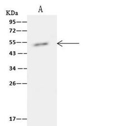 TIPIN Polyclonal Antibody:Antibodies, Polyclonal