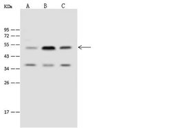 TIPIN Polyclonal Antibody:Antibodies, Polyclonal