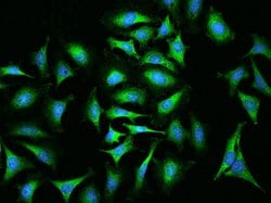 Invitrogen ABCF2 Polyclonal Antibody 100 μL; Unconjugated:Antibodies,