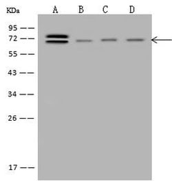 Invitrogen ABCF2 Polyclonal Antibody 100 μL; Unconjugated:Antibodies,