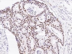 Invitrogen TCF12 Polyclonal Antibody 100 &mu;L; Unconjugated:Antibodies,