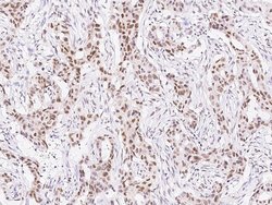 Invitrogen TCF12 Polyclonal Antibody 100 &mu;L; Unconjugated:Antibodies,