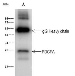 Invitrogen PDGF-A Polyclonal Antibody 100 &mu;L; Unconjugated:Antibodies,