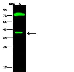 Invitrogen CTBS Polyclonal Antibody 100 &mu;L; Unconjugated:Antibodies,