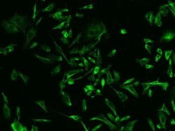 RAB5IF Polyclonal Antibody:Antibodies, Polyclonal