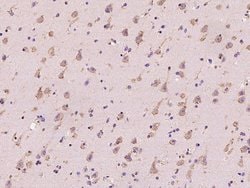 RAB5IF Polyclonal Antibody:Antibodies, Polyclonal
