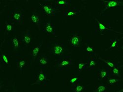 Invitrogen CINP Polyclonal Antibody 100 &mu;L; Unconjugated:Antibodies,