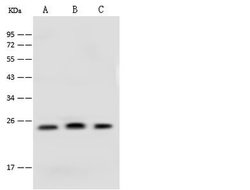 Invitrogen CINP Polyclonal Antibody 100 &mu;L; Unconjugated:Antibodies,