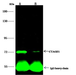 Invitrogen CTAGE1 Polyclonal Antibody 100 &mu;L; Unconjugated:Antibodies,