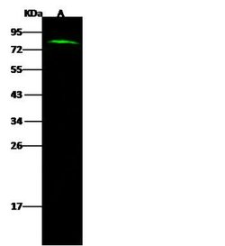 Invitrogen CTAGE1 Polyclonal Antibody 100 &mu;L; Unconjugated:Antibodies,
