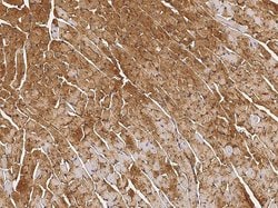 Invitrogen HSPB7 Polyclonal Antibody 100 μL; Unconjugated:Antibodies,