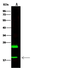 Invitrogen HSPB7 Polyclonal Antibody 100 μL; Unconjugated:Antibodies,