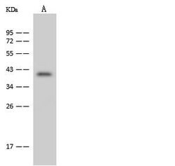 Invitrogen FBXO28 Polyclonal Antibody 100 &mu;L; Unconjugated:Antibodies,
