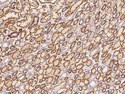Invitrogen ATP Synthase beta Polyclonal Antibody 100 &mu;L; Unconjugated:Antibodies,
