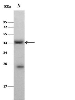 Invitrogen CLEC9A Polyclonal Antibody 100 &mu;L; Unconjugated:Antibodies,