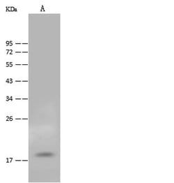 Invitrogen FAM96B Polyclonal Antibody 100 &mu;L | Buy Online | Invitrogen&trade; | Fisher Scientific
