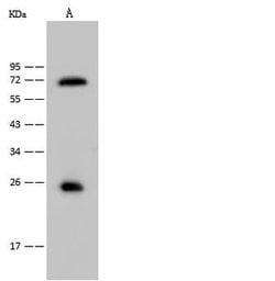 Invitrogen&trade;&nbsp;Sostdc1 Polyclonal Antibody