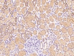 Invitrogen P2Y6 Polyclonal Antibody 100 &mu;L; Unconjugated:Antibodies,