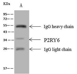 Invitrogen P2Y6 Polyclonal Antibody 100 &mu;L; Unconjugated:Antibodies,