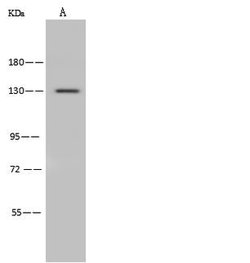 Invitrogen ADAMTS10 Polyclonal Antibody 100 &mu;L; Unconjugated:Antibodies,