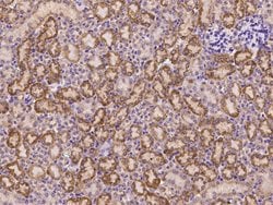 Invitrogen FCAMR Polyclonal Antibody 100 &mu;L; Unconjugated:Antibodies,