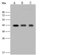 Invitrogen CD38 Polyclonal Antibody 100 μL; Unconjugated:Antibodies,