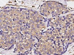 Invitrogen S100A6 Polyclonal Antibody 100 μL; Unconjugated:Antibodies,