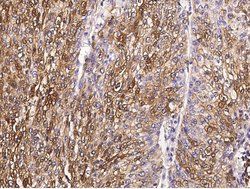 Invitrogen S100A6 Polyclonal Antibody 100 μL; Unconjugated:Antibodies,