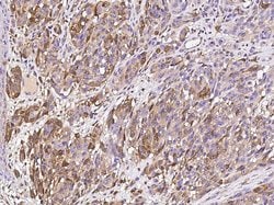 Invitrogen S100A6 Polyclonal Antibody 100 μL; Unconjugated:Antibodies,