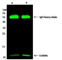 Invitrogen S100A6 Polyclonal Antibody 100 μL; Unconjugated:Antibodies,