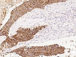 Folate Receptor alpha Polyclonal Antibody, Invitrogen 100 &mu;L; Unconjugated:Antibodies,
