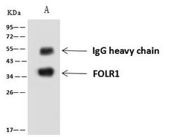 Folate Receptor alpha Polyclonal Antibody, Invitrogen 100 &mu;L; Unconjugated:Antibodies,