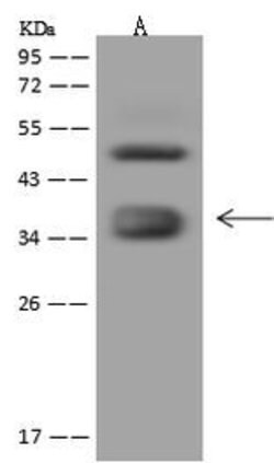 Folate Receptor alpha Polyclonal Antibody, Invitrogen 100 &mu;L; Unconjugated:Antibodies,