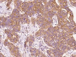 Invitrogen BNIP3L Polyclonal Antibody 100 &mu;L; Unconjugated:Antibodies,