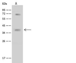 Invitrogen BNIP3L Polyclonal Antibody 100 &mu;L; Unconjugated:Antibodies,