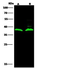 Invitrogen LRP15 Polyclonal Antibody 100 &mu;L; Unconjugated:Antibodies,