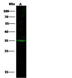 Invitrogen DHRS9 Polyclonal Antibody 100 μL; Unconjugated:Antibodies,