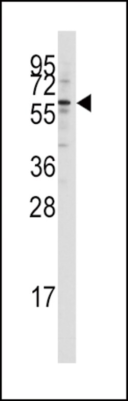 Invitrogen TIP60 Polyclonal Antibody 400 &mu;L; Unconjugated:Antibodies,