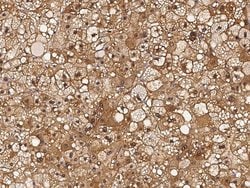 Invitrogen RBKS Polyclonal Antibody 100 μL; Unconjugated:Antibodies,