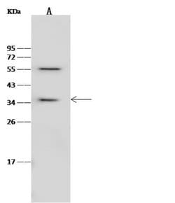Invitrogen RBKS Polyclonal Antibody 100 μL; Unconjugated:Antibodies,