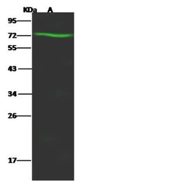 Invitrogen GGT5 Polyclonal Antibody 100 &mu;L; Unconjugated:Anticorps,