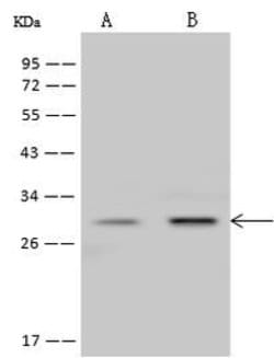 Invitrogen PrP Polyclonal Antibody 100 &mu;L; Unconjugated:Antibodies,