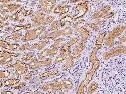 Invitrogen KBP Polyclonal Antibody 100 &mu;L; Unconjugated:Antibodies,